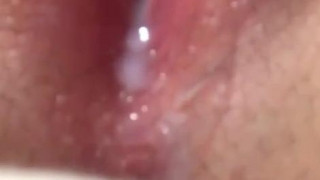 우리 보미 숨쉴때마다 물흘러나와요